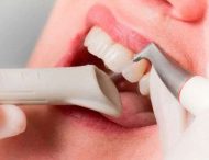 Практичні поради для правильної чистки зубів