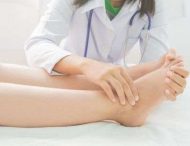 Набряки ніг: коли йти до лікаря?