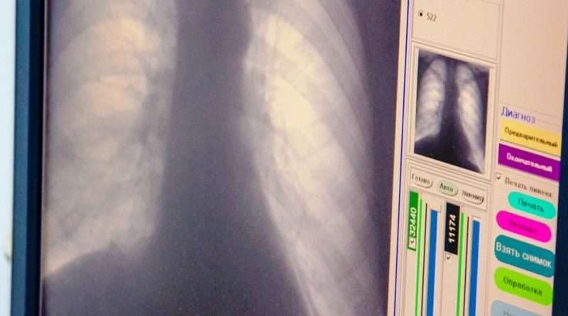 Як мешканцям Дніпропетровщини захиститися від небезпечного інфекційного захворювання Як мешканцям Дніпропетровщини захиститися від небезпечного інфекційного захворювання