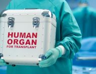 Р​одичам померлих дозволять передавати тіла «на органи»