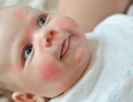 Як захистити дитину від алергії?