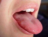 Про що розкаже колір вашого язика?