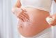 Профілактика розтяжок під час вагітності