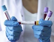 В Україну завезуть тести на коронавірус за 300 гривень
