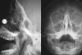 Австралийский ученый попал в больницу с магнитами в носу, пытаясь создать устройство от коронавируса