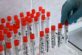 За добу на Дніпропетровщині – 56 нових випадків коронавірусної інфекції