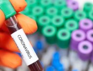 На Дніпропетровщині виявили 12 нових випадків коронавірусу