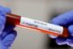 На Дніпропетровщині – 6 нових випадків коронавірусу