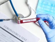 За сутки в Украине коронавирусом заразились еще 819 человек