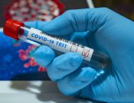 У Дніпропетровській області виявили 30 нових випадків коронавірусу.