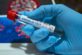 У Дніпропетровській області виявили 30 нових випадків коронавірусу.