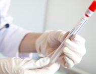 На Дніпропетровщині виявили 21 новий випадок коронавірусу.