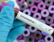 За останню добу у Нікополі виявили 1 випадок короновірусної хвороби.