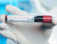 104 мешканці Дніпропетровщини захворіли на коронавірус