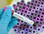 На Дніпропетровщині статистично зареєстровано ще 1254 випадки коронавірусу