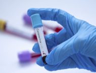 На Дніпропетровщині статистично зареєстровано ще 952 випадки коронавірусу