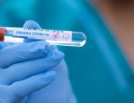 За минулу добу у Дніпропетровській області зареєстрували 438 нових випадків коронавірусу