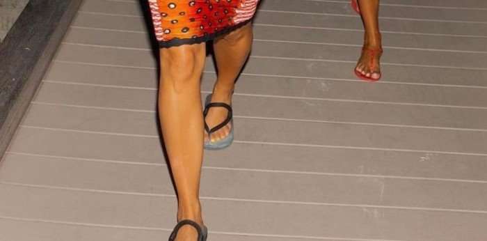 У Ким Кардашьян снова нашли на ноге шестой палец У Ким Кардашьян снова нашли на ноге шестой палец