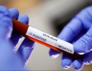 На Дніпропетровщині статистично зареєстровано ще 870 випадків коронавірусу