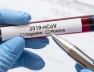 На Дніпропетровщині виявили 798 нових випадків коронавірусу