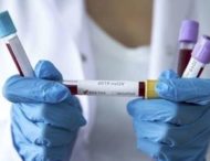 На Дніпропетровщині зафіксували 709 нових випадків коронавірусу