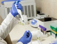 На Дніпропетровщині виявили 295 нових випадків коронавірусу