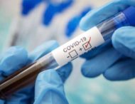 За добу на Дніпропетровщині виявили 223 випадки коронавірусу