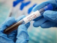 На Дніпропетровщині виявили 665 нових випадків коронавірусу