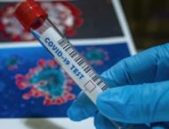На Дніпропетровщині зросла кількість нових випадків коронавірусу