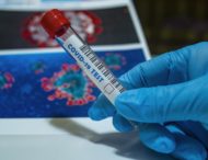 На Дніпропетровщині за минулу добу виявили 761 випадок коронавірусу, одужали 727 людей