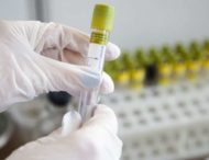 За сутки на Днепропетровщине обнаружили новые случаи коронавируса