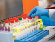 На Днепропетровщине подтвердили новые случаи коронавирусной инфекции