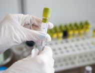 На Дніпропетровщині виявили 148 нових випадків коронавірусу