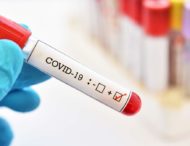 На Дніпропетровщині підтвердили 209 нових випадків COVID-19