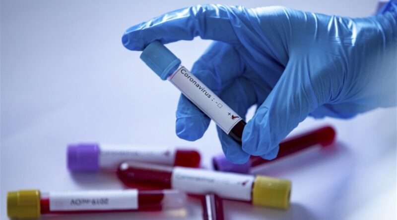 За прошедшие сутки на Днепропетровщине выявили новые случаи коронавирусной инфекции