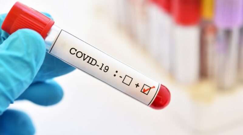 Днепропетровская область в лидерах по количеству заболевших коронавирусом Днепропетровская область в лидерах по количеству заболевших коронавирусом