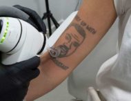 Другий шанс: у Лондоні безкоштовно видаляють татуювання з Каньє Вестом