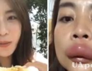 Жінка знайшла природний спосіб збільшити губи та насмішила мережу (відео)
