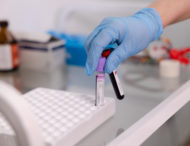 Понад 1500 людей пройшли «Скринінг здоров’я 40+» на Дніпропетровщині