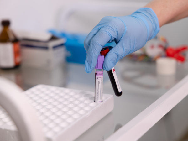 Понад 1500 людей пройшли «Скринінг здоров’я 40+» на Дніпропетровщині (93737)