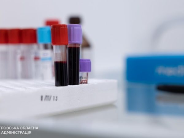 Майже 3 тис мешканців Дніпропетровщини пройшли «Скринінг здоров’я 40+» (93946)