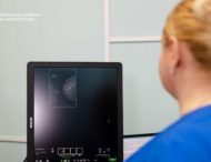 3D-мамографія і променева терапія: як на Дніпропетровщині виявляють та лікують рак молочної залози